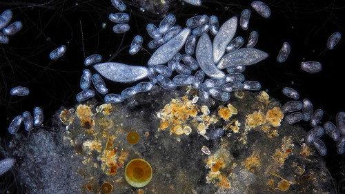 Planeta Microbio filmas žiurėti online