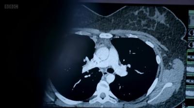 Surgeons: At the Edge of Life