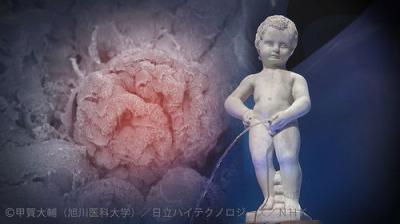 NHKスペシャル