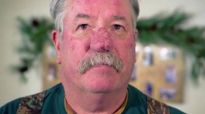 Dr. Pimple Popper
