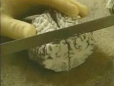 Forensic Files