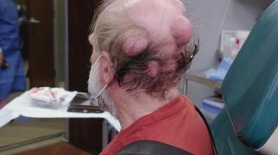 Dr. Pimple Popper