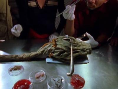 Tremors