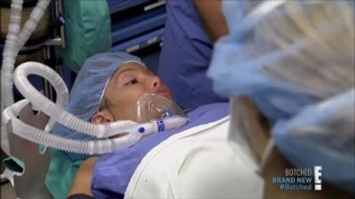 Botched