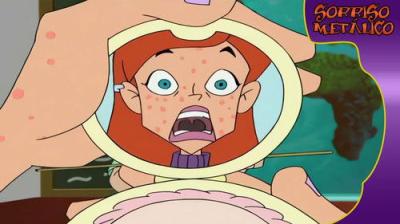 Braceface